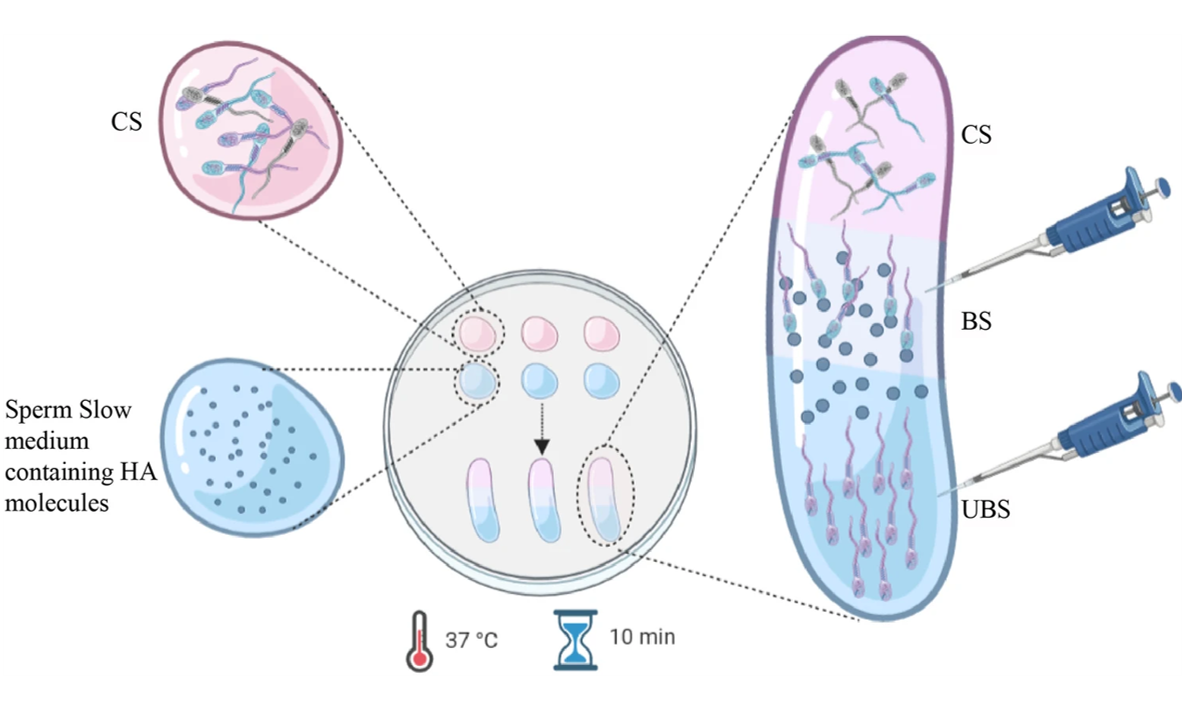 PICSI技术：试管婴儿的＂精子质检员＂