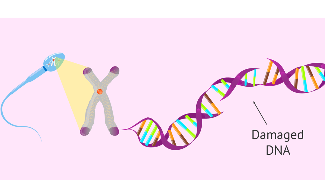 准备做IVF，DFI高了别慌！一篇看懂咋调理