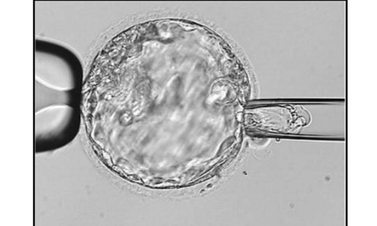 三代试管婴儿：优生优育的 “筛选神器”