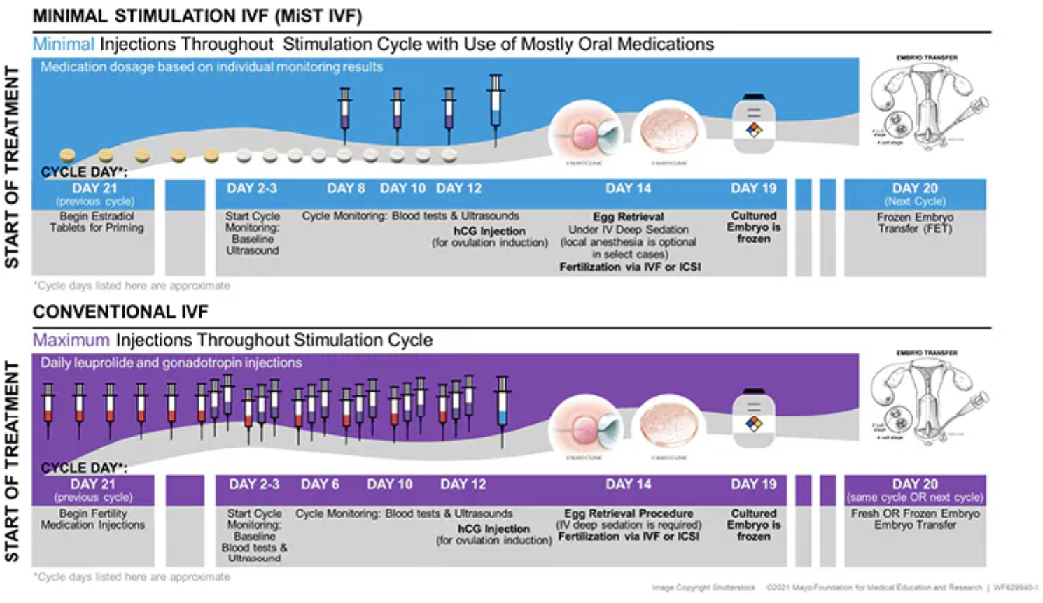 试管婴儿微刺激方案：温和促排新选择